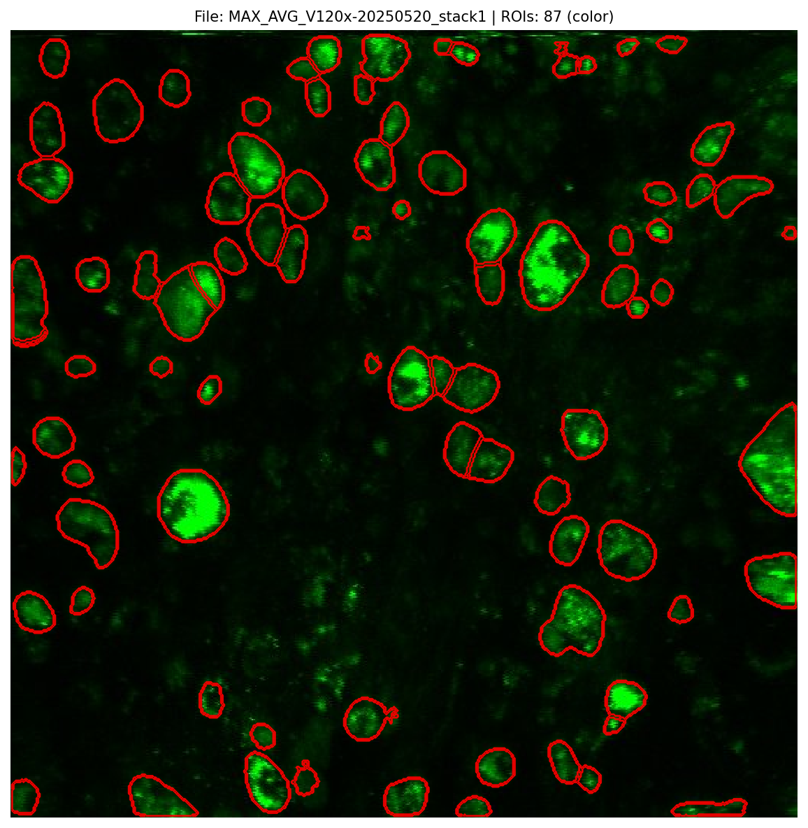 Segmentation Preview